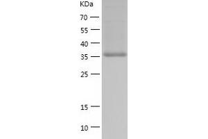 BCAT1 Protein (AA 1-386) (His tag)