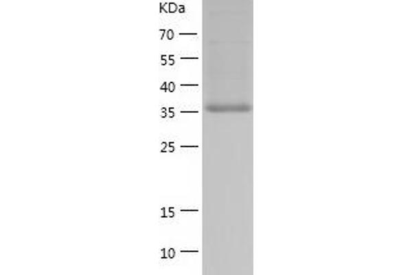 BCAT1 Protein (AA 1-386) (His tag)