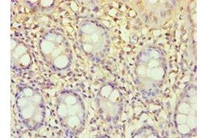 Immunohistochemistry of paraffin-embedded human colon tissue using ABIN7151765 at dilution of 1:100 (ECE2 抗体  (AA 1-160))