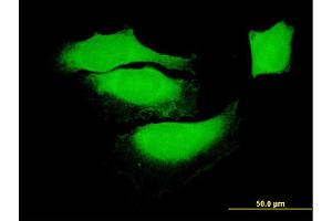 Immunofluorescence of monoclonal antibody to BAG1 on HeLa cell. (BAG1 抗体  (AA 241-345))
