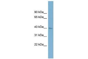 A4GALT antibody used at 1 ug/ml to detect target protein. (A4GALT 抗体)