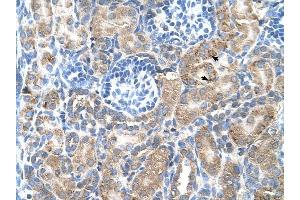 SGPP2 antibody was used for immunohistochemistry at a concentration of 4-8 ug/ml to stain Epithelial cells of renal tubule (arrows) in Human Kidney.