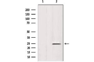 Western blot analysis of extracts from rat spleen, using IFT25 antibody. (HSPB11 抗体  (N-Term))