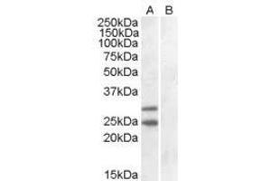 Image no. 2 for anti-Suppressor of Cytokine Signaling 1 (SOCS1) (C-Term) antibody (ABIN374072) (SOCS1 抗体  (C-Term))