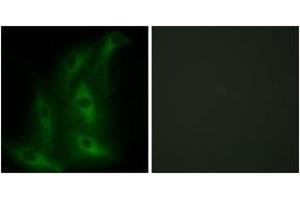 Immunofluorescence (IF) image for anti-Collagen, Type IV, alpha 6 (COL4a6) (AA 1201-1250) antibody (ABIN1534342)