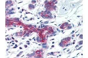 Human Breast (formalin-fixed, paraffin-embedded) stained with AIFM3at 5 µg/ml followed by biotinylated goat anti-rabbit IgG secondary antibody, alkaline phosphatase-streptavidin and chromogen. (AIFM3 抗体  (Center))
