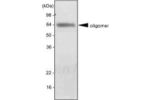 Western blot analysis of mouse liver extract was resolved by SDS - PAGE , transferred to PVDF membrane and probed with ADIPOQ monoclonal antibody , clone 5H7 (1 : 2000)  . (ADIPOQ 抗体  (AA 15-244))