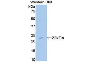 Western Blotting (WB) image for anti-Bleomycin Hydrolase (BLMH) (AA 30-165) antibody (ABIN3201698) (BLMH 抗体  (AA 30-165))