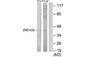 Western Blotting (WB) image for anti-Zinc Finger and SCAN Domain Containing 16 (ZSCAN16) (AA 191-240) antibody (ABIN2889761) (ZSCAN16 抗体  (AA 191-240))