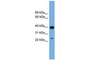 Image no. 1 for anti-Suppressor of Cytokine Signaling 1 (SOCS1) (AA 107-156) antibody (ABIN6744715) (SOCS1 抗体  (AA 107-156))