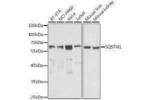 Western blot analysis of extracts of various cell lines, using SQSTM1 antibody. (SQSTM1 抗体  (AA 1-440))