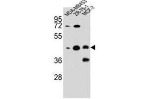 Western blot analysis of hCG_1645727 Antibody (C-term) in MDA-MB453,ZR-75-1,MCF-7 cell line lysates (35ug/lane). (KBTBD13 抗体  (C-Term))