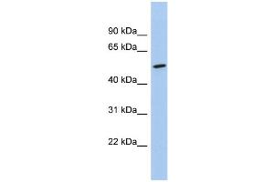 WB Suggested Anti-NKD1 Antibody Titration:  0. (NKD1 抗体  (Middle Region))