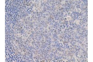 ABIN6261631 and ABIN6268696 at 1/100 staining human normal tonsil tissue by IHC-P.