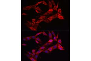 Immunofluorescence analysis of NIH/3T3 cells using ASNS Rabbit pAb (ABIN6127372, ABIN6137209, ABIN6137210 and ABIN6221207) at dilution of 1:50 (40x lens).