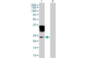 Western Blot analysis of ORM2 expression in transfected 293T cell line by ORM2 MaxPab polyclonal antibody.