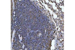 IHC analysis of ERP29 using anti-ERP29 antibody (ABIN7601342). (ERP29 抗体  (AA 33-196))