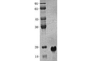 Western Blotting (WB) image for Protein Kinase (CAMP-Dependent, Catalytic) Inhibitor beta (PKIB) (Transcript Variant 3) protein (His tag) (ABIN2729035)