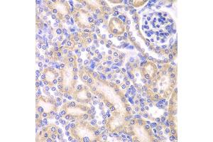Immunohistochemistry of paraffin-embedded rat kidney using AK4 antibody (ABIN5971082) at dilution of 1/200 (40x lens). (AK4 抗体)