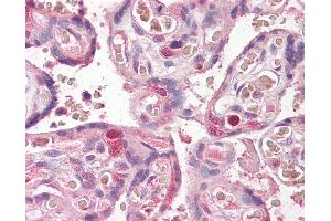 Anti-FANCE antibody IHC of human placenta. (FANCE 抗体  (AA 235-247))