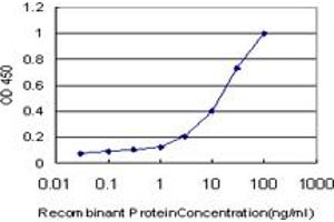 Detection limit for recombinant GST tagged RIPK4 is approximately 0. (RIPK4 抗体  (AA 675-784))
