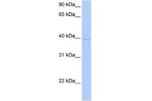 WB Suggested Anti-ZNF385D Antibody Titration:  0. (ZNF385D 抗体  (C-Term))