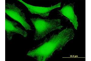 Immunofluorescence of purified MaxPab antibody to SDCBP on HeLa cell. (SDCBP 抗体  (AA 1-298))