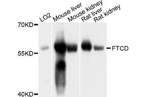 Western blot analysis of extracts of various cell lines, using FTCD antibody. (FTCD 抗体)
