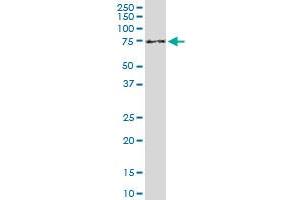 ENTH monoclonal antibody (M03), clone 1E6. (CLINT1 抗体  (AA 161-261))