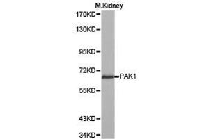Western Blotting (WB) image for anti-P21-Activated Kinase 1 (PAK1) antibody (ABIN1874025) (PAK1 抗体)