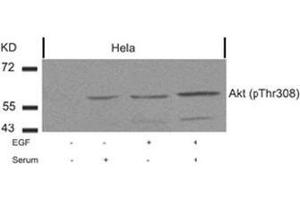Image no. 2 for anti-V-Akt Murine Thymoma Viral Oncogene Homolog 1 (AKT1) (pThr308) antibody (ABIN196710) (AKT1 抗体  (pThr308))