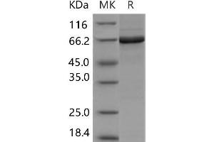 Western Blotting (WB) image for PTK6 Protein tyrosine Kinase 6 (PTK6) (Active) protein (GST tag,His tag) (ABIN7320007)