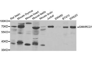 Western blot analysis of extracts of various cell lines, using SMARCD1 antibody (ABIN5973730) at 1/1000 dilution. (SMARCD1 抗体)