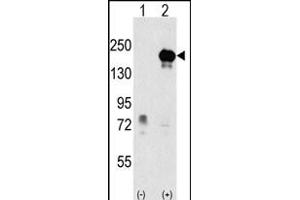 Western blot analysis of EHMT1 (arrow) using rabbit polyclonal EHMT1 Antibody (Center) (ABIN387856 and ABIN2844018). (EHMT1 抗体  (AA 367-396))