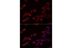 Immunofluorescence analysis of U2OS cell using NRBF2 antibody. (NRBF2 抗体)