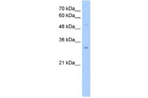 NSUN5C antibody used at 2. (NSUN5P2 抗体  (Middle Region))