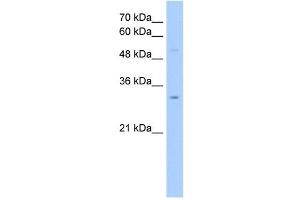 NSUN5C antibody used at 2. (NSUN5P2 抗体  (Middle Region))