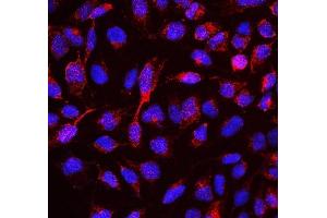 IF analysis of RBMS3 using anti-RBMS3 antibody (ABIN6719584).