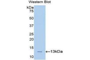 Western Blotting (WB) image for anti-Phospholipase A2-Activating Protein (PLAA) (AA 367-468) antibody (ABIN1860253) (PLAA 抗体  (AA 367-468))