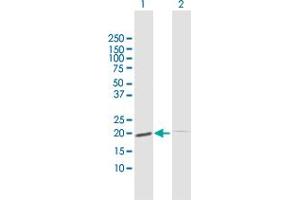 Western Blot analysis of ESM1 expression in transfected 293T cell line by ESM1 MaxPab polyclonal antibody. (ESM1 抗体  (AA 1-184))