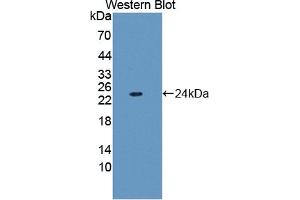 Detection of Recombinant FTL, Human using Polyclonal Antibody to Ferritin, Light Polypeptide (FTL) (FTL 抗体  (AA 2-175))