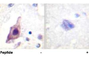 Immunohistochemical analysis of paraffin-embedded human brain tissue using CDC25B polyclonal antibody . (CDC25B 抗体)