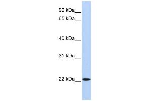 WB Suggested Anti-SSX5 Antibody Titration:  0. (SSX5 抗体  (N-Term))