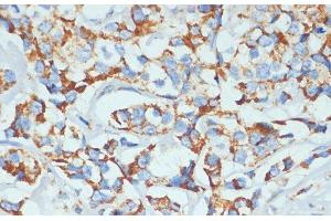 Immunohistochemistry (Paraffin-embedded Sections) (IHC (p)) image for anti-DEAD (Asp-Glu-Ala-Asp) Box Polypeptide 3, X-Linked (DDX3X) antibody (ABIN7261584)