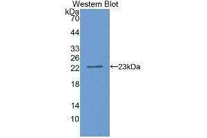 Detection of Recombinant CD27BP, Human using Polyclonal Antibody to CD27 Binding Protein (CD27BP) (SIVA1 抗体  (AA 1-175))