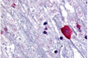 Human Brain, Thalamus (formalin-fixed, paraffin-embedded) stained with BRS3 antibody ABIN213381 at 10 ug/ml followed by biotinylated goat anti-rabbit IgG secondary antibody ABIN481713, alkaline phosphatase-streptavidin and chromogen. (BRS3 抗体  (N-Term))