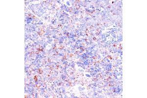 Immunohistochemistry (IHC) image for anti-Integrin beta 2 (ITGB2) (AA 70-170) antibody (ABIN3023118)