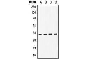 Western blot analysis of CD1b expression in H1299 (A), Jurkat (B), Raw264. (CD1b 抗体  (Center))