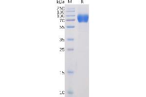 SDS-PAGE (SDS) image for Signaling Lymphocytic Activation Molecule Family Member 1 (SLAMF1) (AA 21-231) protein (mFc-His Tag) (ABIN6961097)