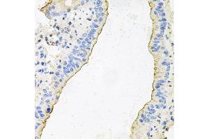 Immunohistochemistry of paraffin-embedded mouse lung using HPR antibody at dilution of 1:100 (x40 lens). (HPR 抗体)
